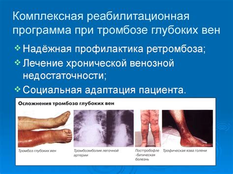 Заболевания вен, нижних конечностей - презентация онлайн
