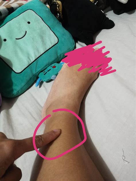 Constant pain in my landing leg : r/FigureSkating