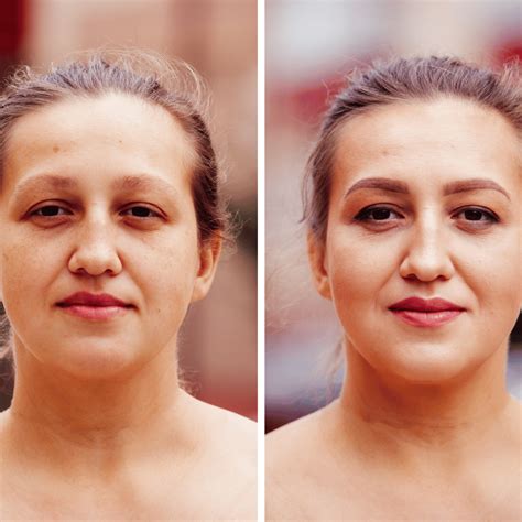 Is Non-Surgical Skin Tightening Possible? Here’s What Science Says