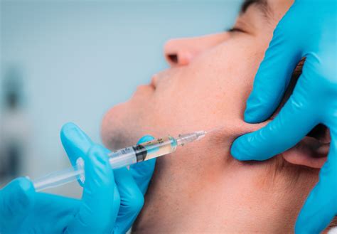 How Jawline Filler Became The Must-Have Treatment | Fox Clinic Wholesale