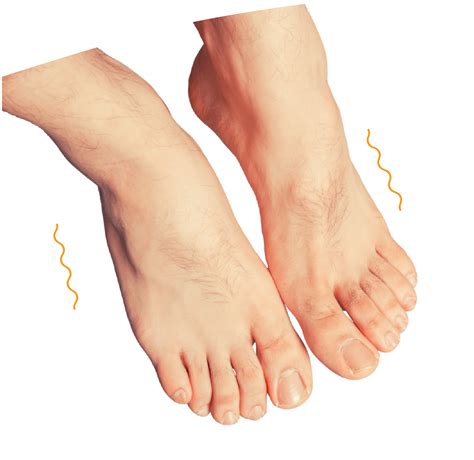 Circulation Problems - South Bay Vascular Center and Vein Institute