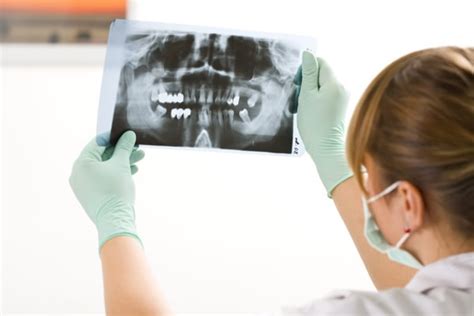Рентгенодиагностика в Москве | Med & Care