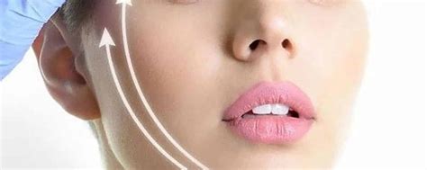 HIFU Face Lifting Treatment