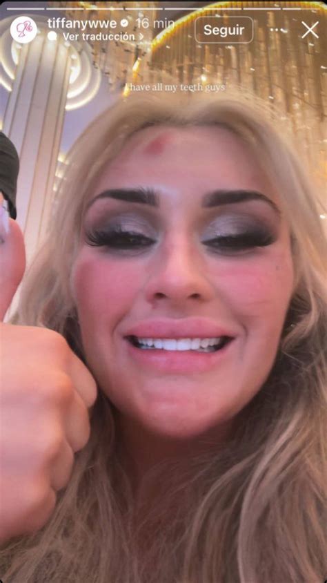 ¿Tiffany Stratton perdió dientes en WrestleMania 41? La Campeona de WWE