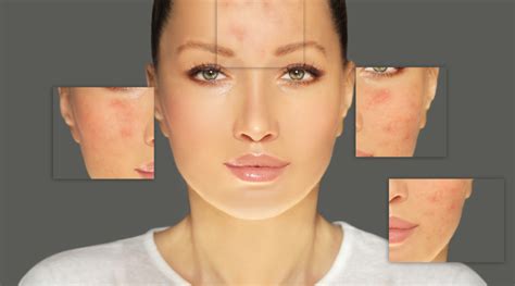 Skin Diseases: A Look Into Its Various Types - HealthKart