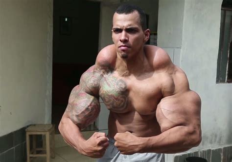 Synthol: what it is and the consequences of using it – Todo Doping
