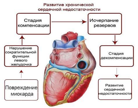 Декомпенсированная сердечная недостаточность: что это такое, формы, как ...