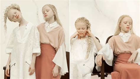 Stunning Twin Teens With Albinism Take Modeling Industry by Storm | Allure