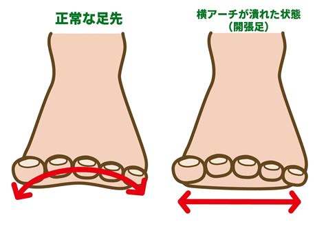 【外反母趾】「開張足」を自分で改善しよう！ | 100年後も必要とされる整体院【百年整体】