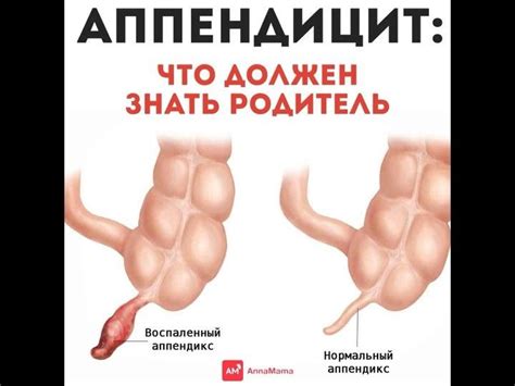 Pin on Новорожденные