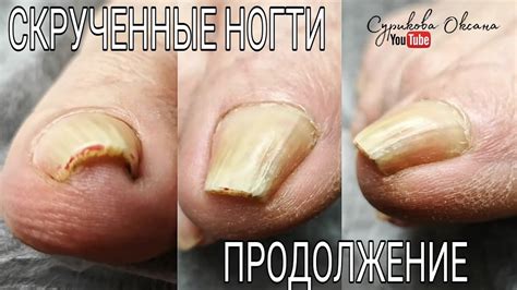 Язвы на ногах фото начальная стадия фото как выглядит