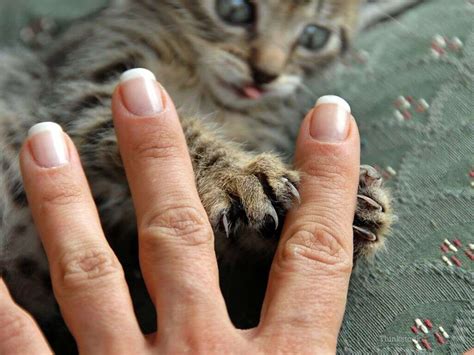 Cat Scratch Disease: Cat Scratch Disease Symptoms, Treatments & More