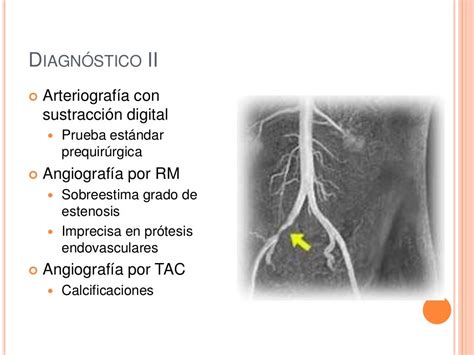 Enfermedades vasculares