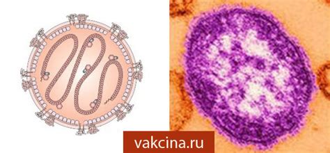 Корь у детей и взрослых - симптомы, последствия, профилактика