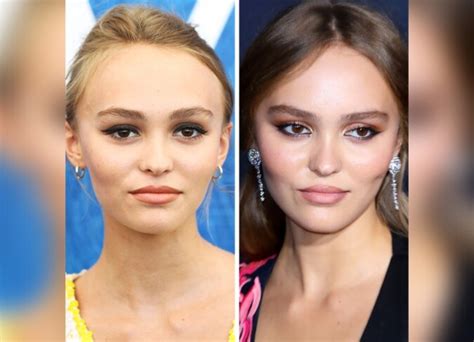 Lily-Rose Depp's Plastic Surgery: Did The Model Willingly Have Plastic ...