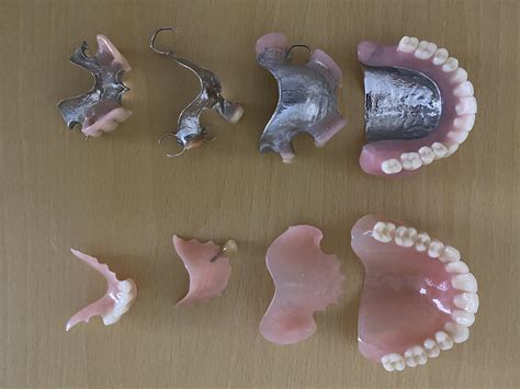 denture acrylic allergy  patricia salinas blog