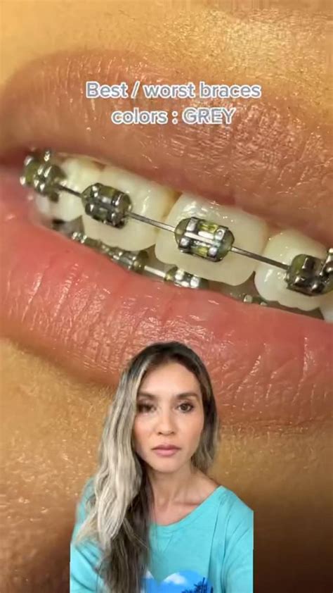 braces colors grey  teeth braces braceson braces colors