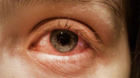 Eyebright | Таны дурлах арьс арчилгааны бүтээгдэхүүн