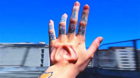 subdermal implants      youtube