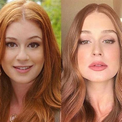 Lipoenxertia No Rosto Antes E Depois - Lipoenxertia Face Fotos Antes E Depois - Livros