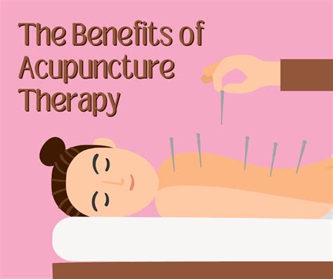 The Benefits of Acupuncture Therapy » Back Pain Insider