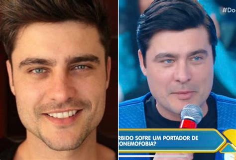 Guilherme Rocker Antes E Depois - Aparência de Guilherme Leicam chama atenção na web: 'Desarmonização ...