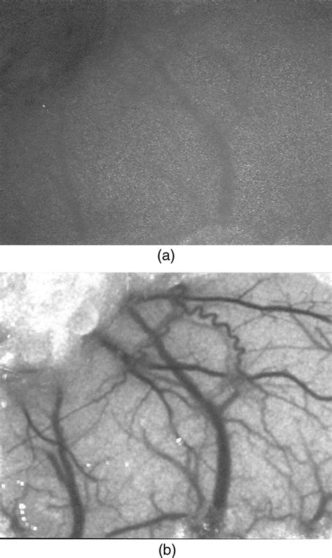 raw image  part   rat cortex    lsci version