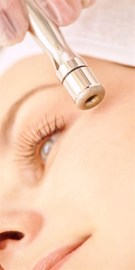 Diamond Dermabrasion - Cinderella Beauty