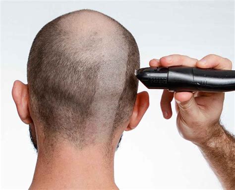 I AM GOING BALD TO FEED THE HUNGER - SJ Echo