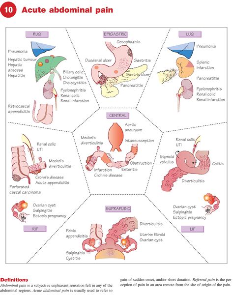 Acute Abdominal Pain - Regional Causes, Red Flags & Emergency Management