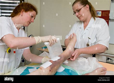 LEG ULCERS CARE Stock Photo - Alamy