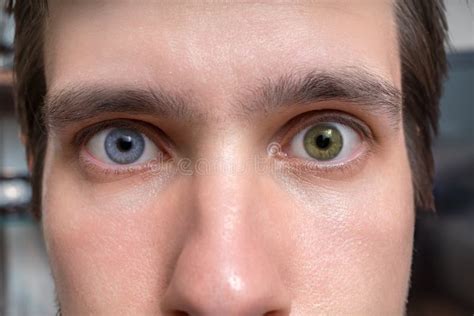 Молодой человек с Heterochromia - 2 различных покрашенных глаза ...