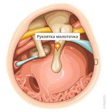 Рукоятка молоточка - e-Anatomy - IMAIOS