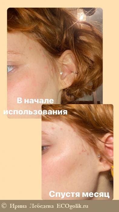 Гель для умывания антибактериальный с ферментами ржи | Отзыв | Ирина ...