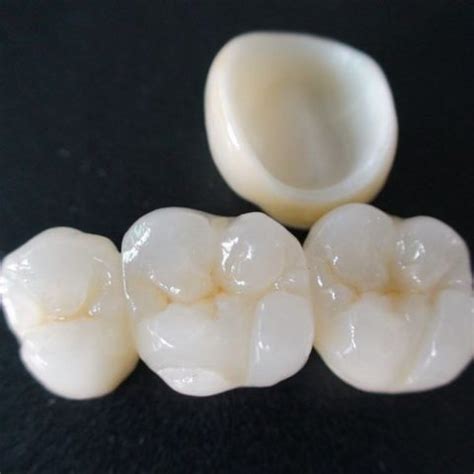 ZIRCONIA CROWNS – DENTAL IMPLANT SPECIALITY CENTRE