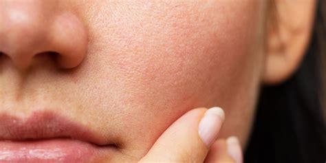 The Dermis: Protector and Producer - DermaSpark Products Inc.