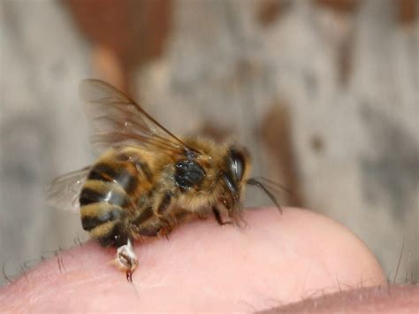 Bee sting therapy – revisited – Life Lines by Dr. Dolittle