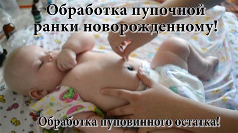 Обработка пупочной ранки новорожденному и пуповинного остатка! УЗНАЙТЕ ...