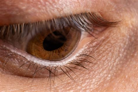 Corneal Remodeling Shows Long-Term Safety, Effectiveness ...