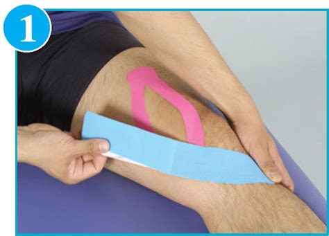Patellofemoral Pain Syndrome Taping