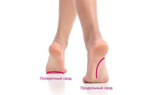 Как подобрать обувь при плоскостопии?