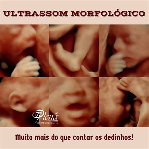 Qual O Valor Da Ultrassom Morfológica - ULTRASSOM MORFOLÓGICO ULTRASSONOGRAFIA MORFOLÓGICA?