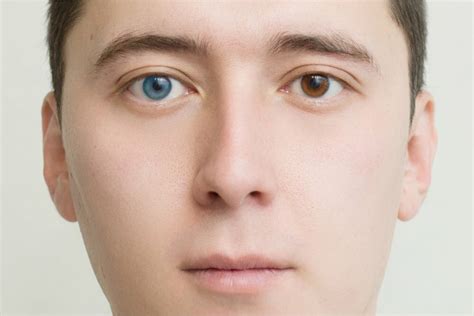 «Гетерохромия у людей: почему может отличаться цвет глаз?» — Яндекс Кью