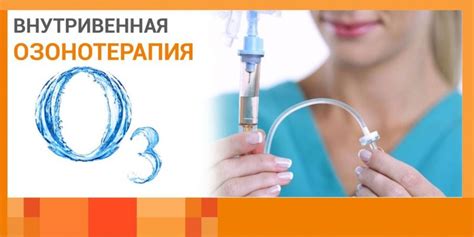 Озонотерапия внутривенно