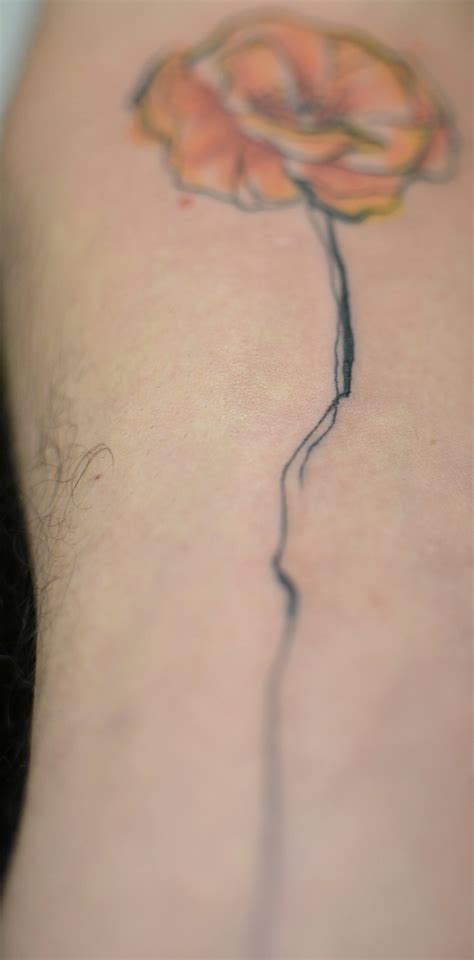 saniderm tattoo aftercare