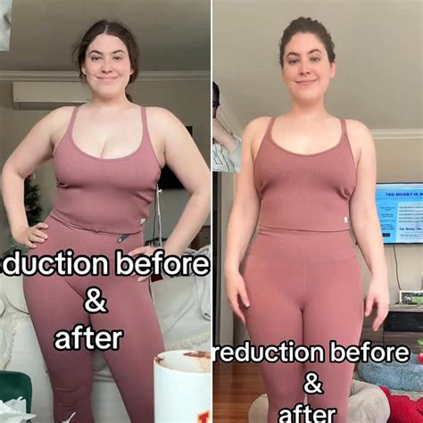 Gigi Robinson Opens Up About Breast Reduction for Chronic Illness | Us