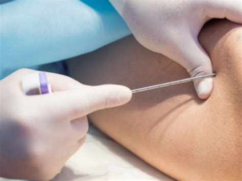Caroço No Braço O Que Pode Ser - Caroço no braço: como identificar causas e quando procurar um médico