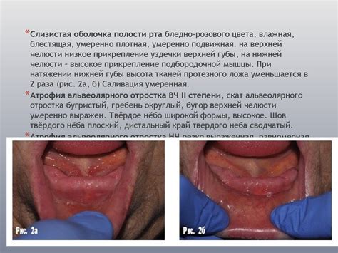Ортопедическая стоматология. История болезни - презентация онлайн