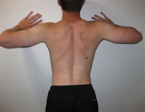 scapular protraction student omt