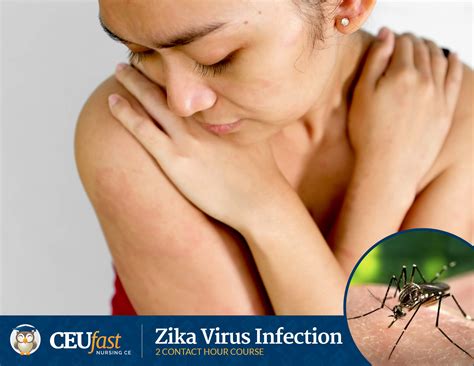 Free Zika CE Course Launched To Prepare Nurses, Health Professionals